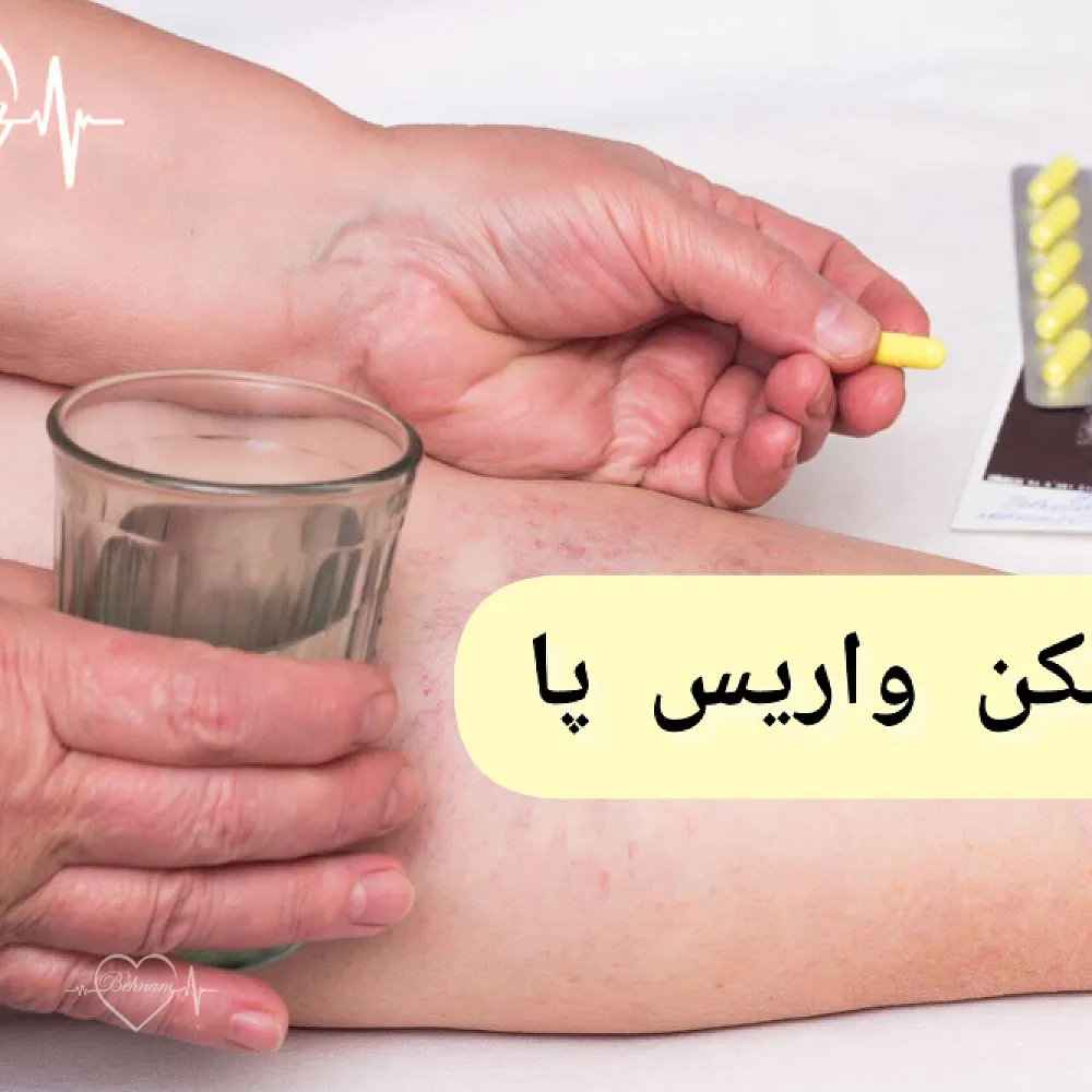 أفضل مسكن لآلام دوالي الساقين: كيفية تناوله + الآثار الجانبية