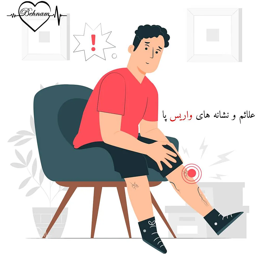 أكمل علامات وأعراض دوالي الساقين: علامة جديدة وأقل شهرة!