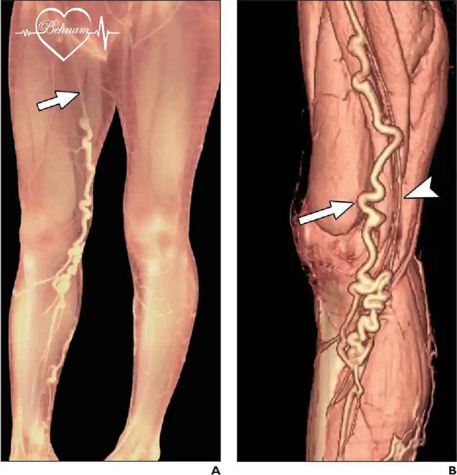  ونوگرافی : انواع، مراحل انجام و توصیه ها