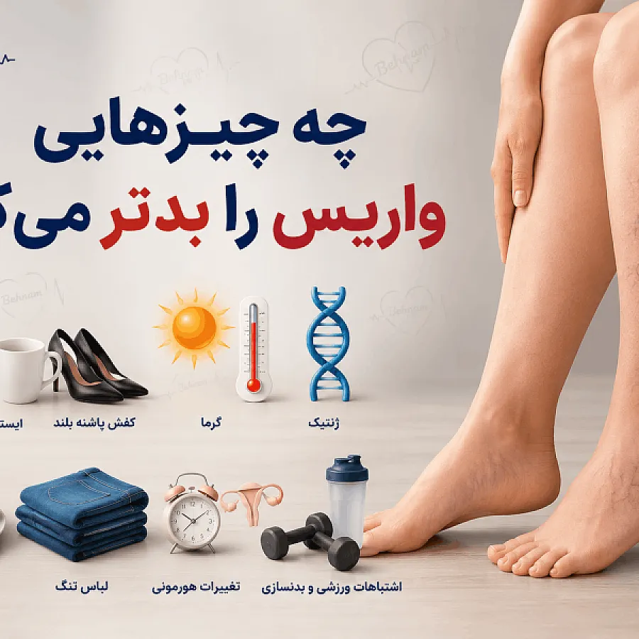 چه چیزهایی واریس را بدتر می کنند؟۸ عامل مهم+راهکارها