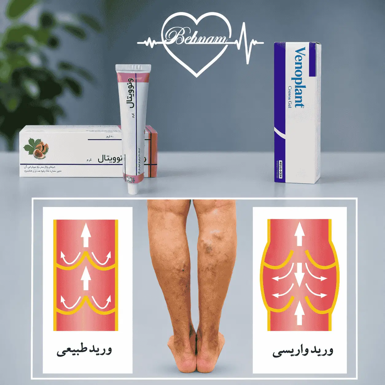 بهترین پماد و کرم واریس