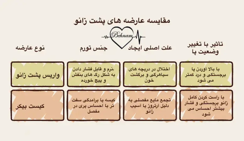 تشخیص واریس پشت زانو