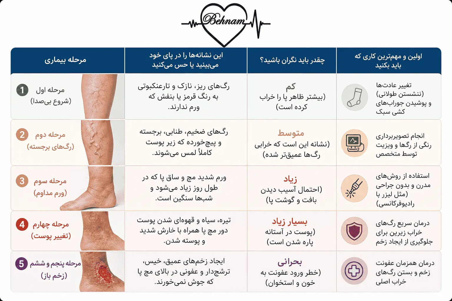 مراحل پیشرفت و خطرات واریس پا