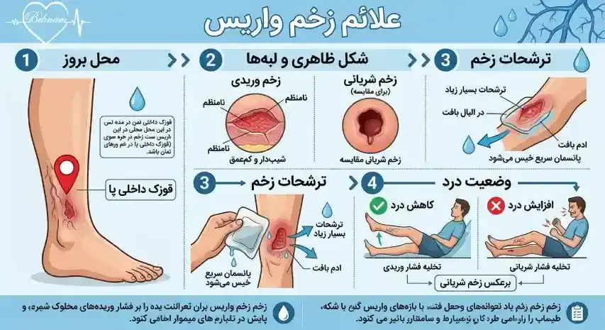 علائم زخم واریس