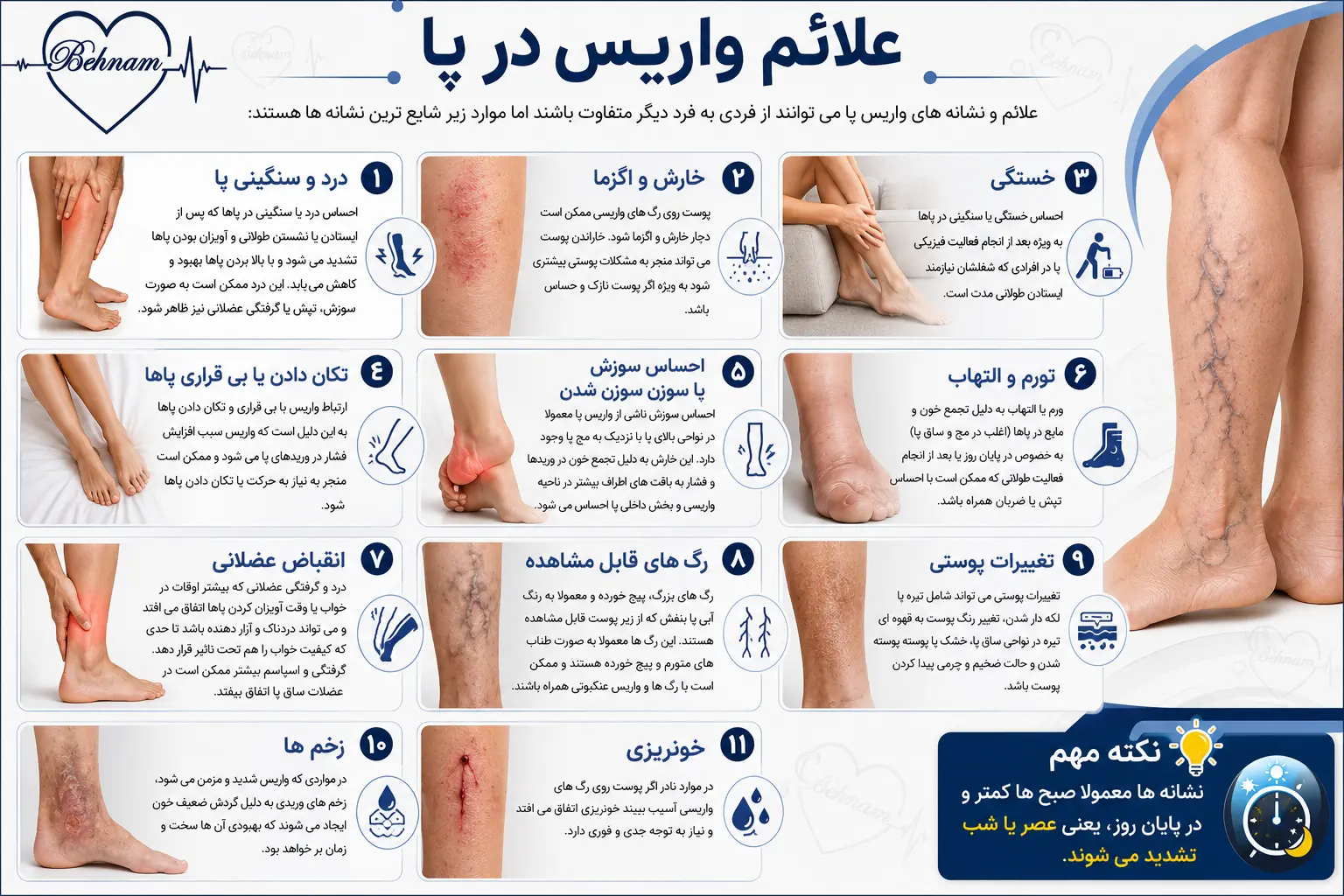 واریس پا چه علائمی داره
