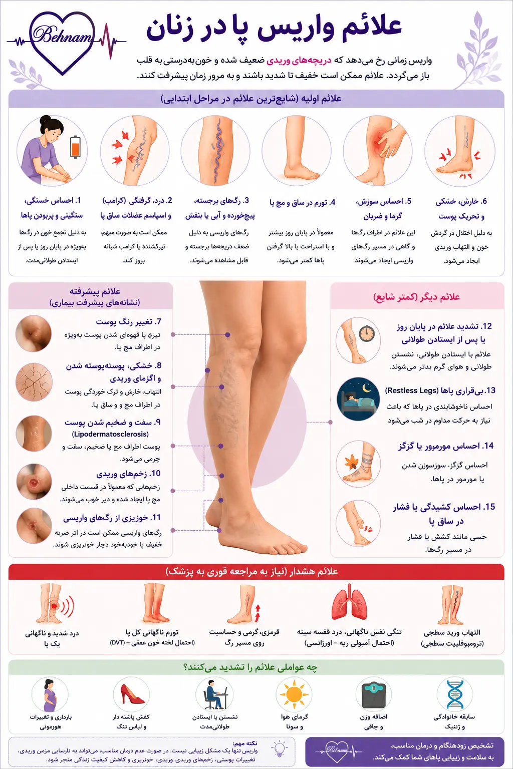 علائم واریس پا در زنان