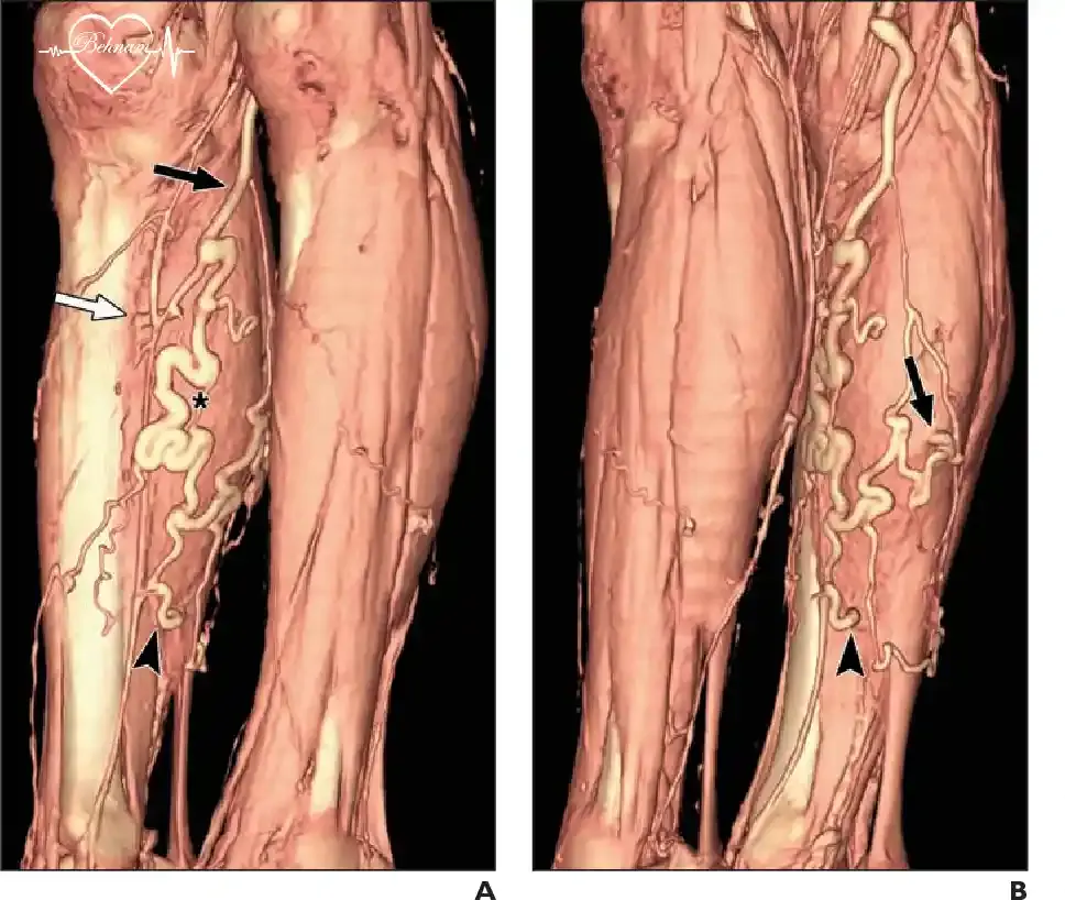 ونوگرافی چیست