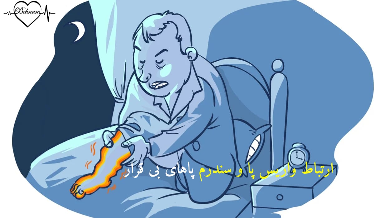درمان سندرم پای بی قرار