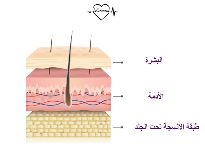 اسباب علامات التمدد