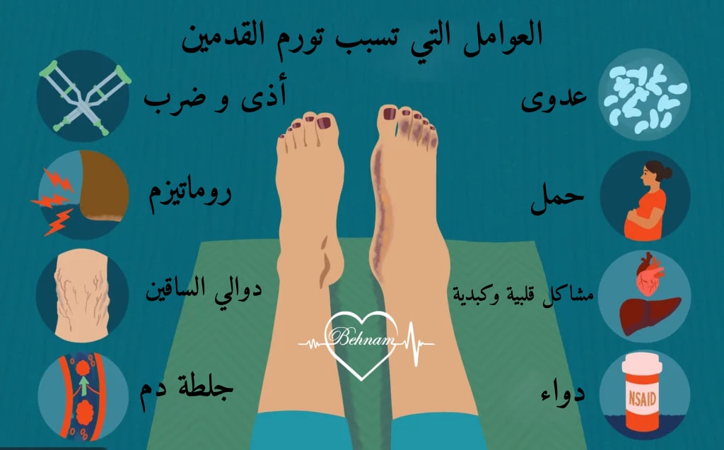 أسباب تورم القدمین