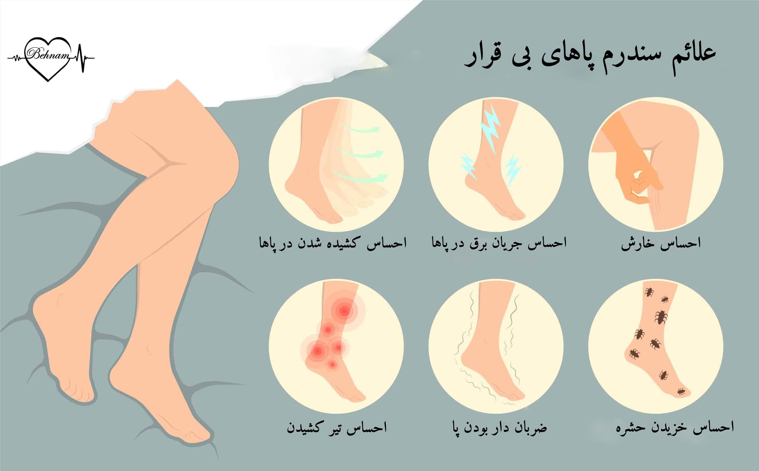 ارتباط واریس و سندرم پاهای بی قرار