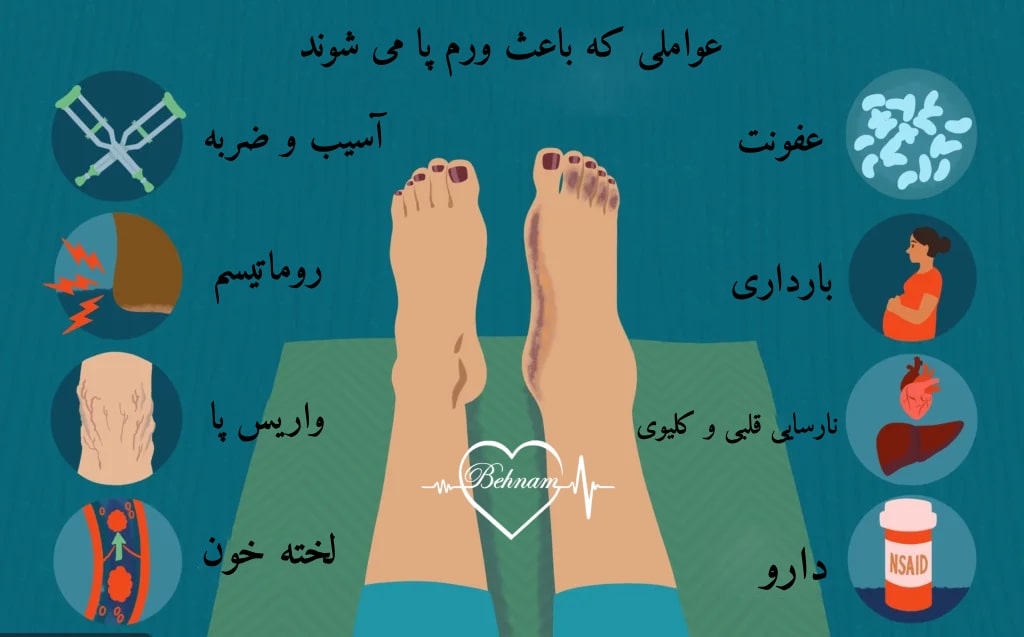 دلایل ورم پاها
