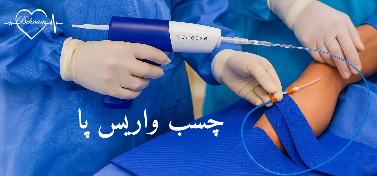 عکس چسب واریس
