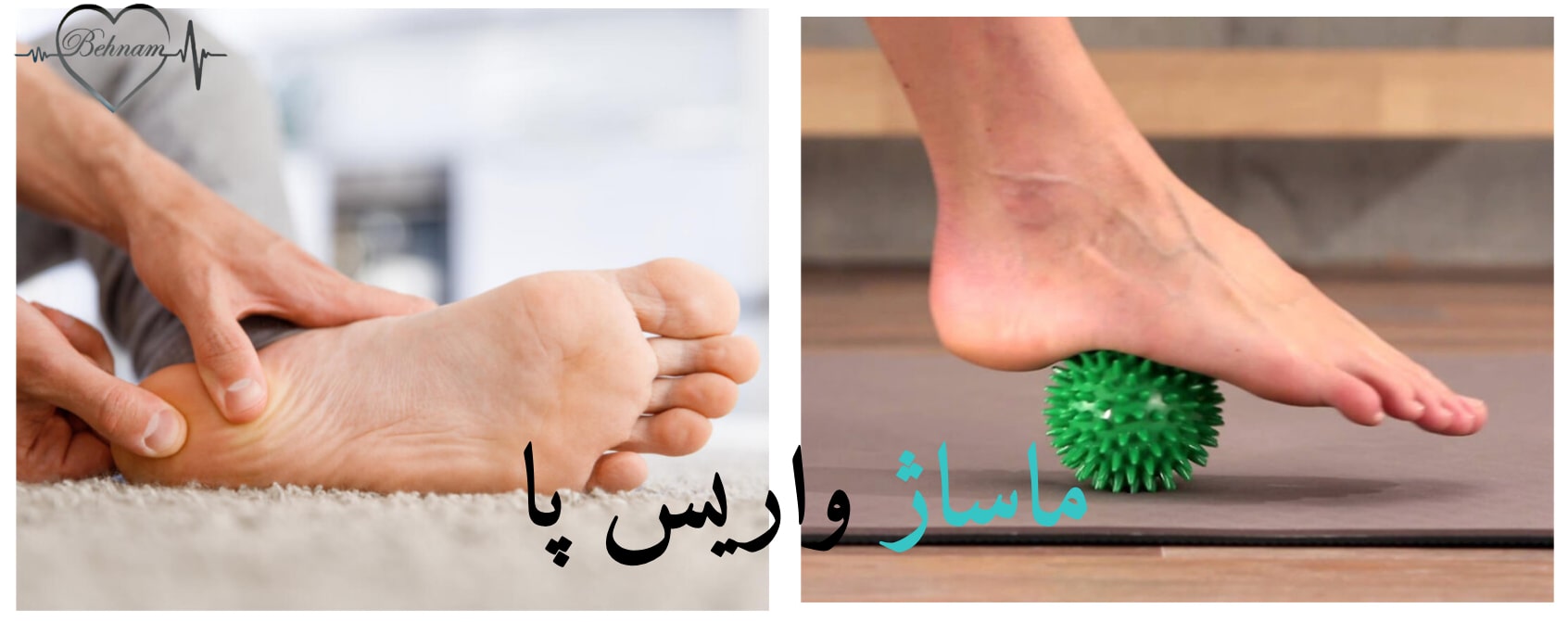 ماساژ واریس پا