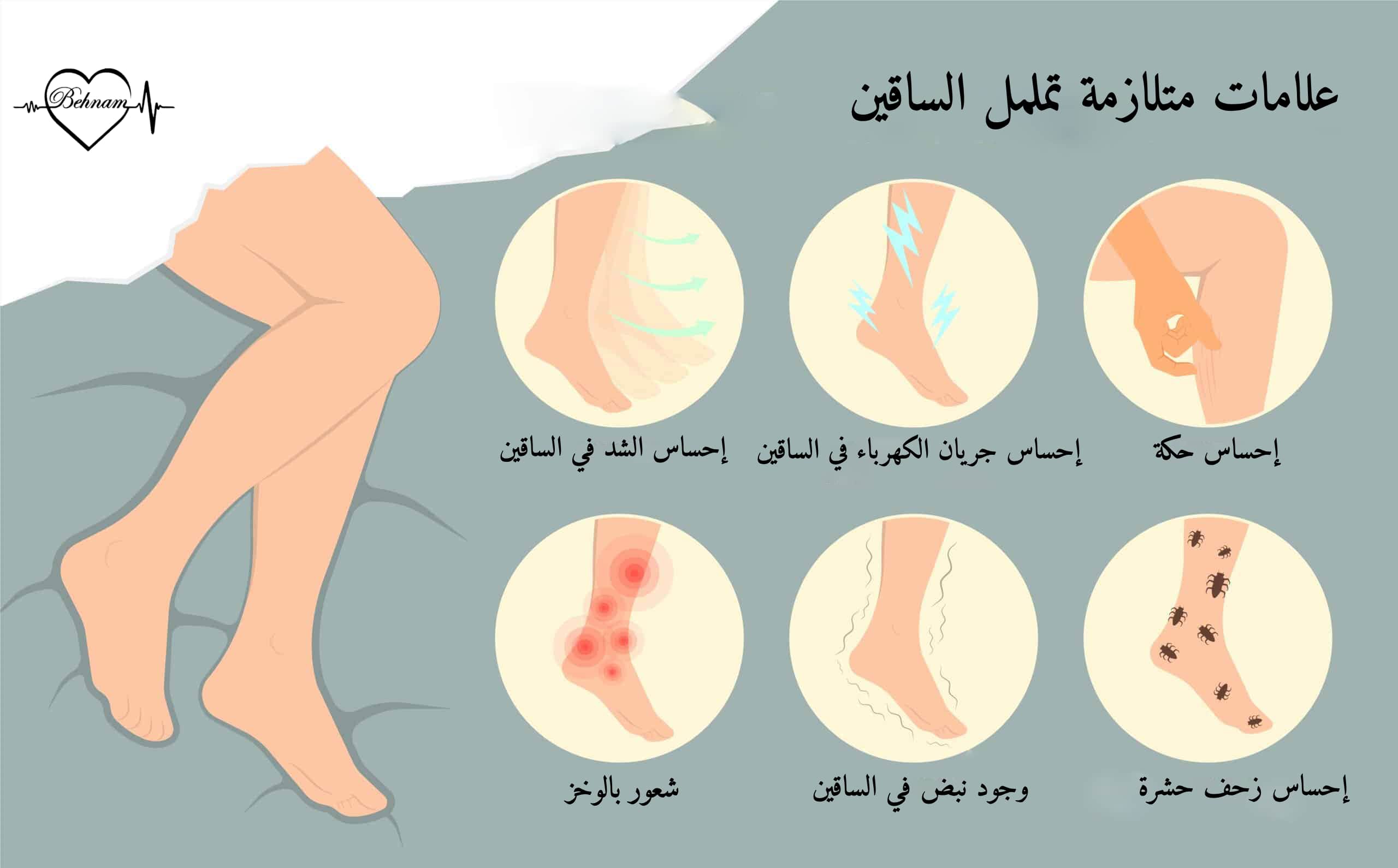 متلازمة تململ الساقين
