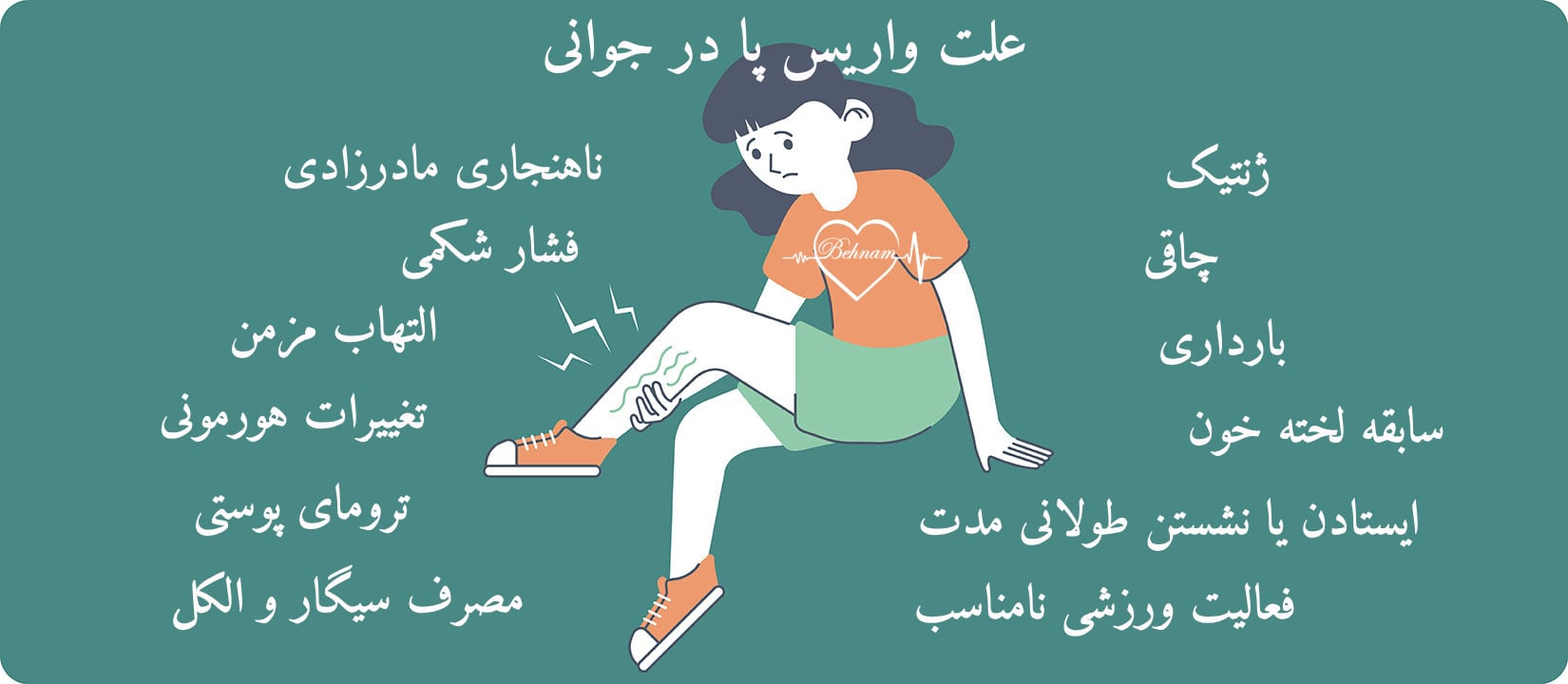 علت واریس پا در جوانی