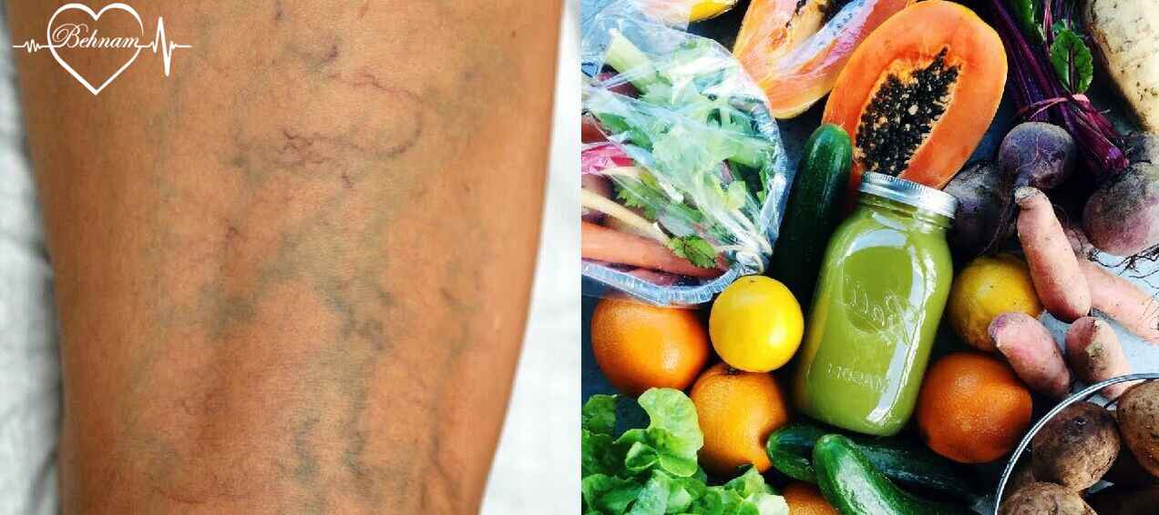 Healthy foods for varicose veins