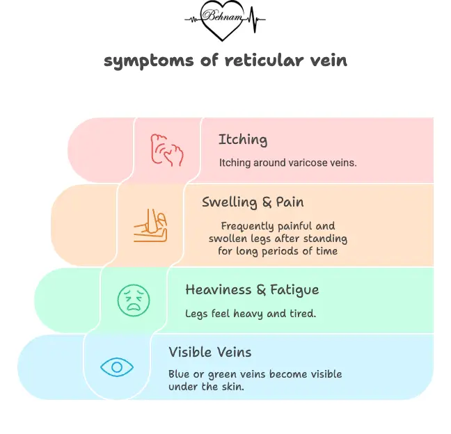 Signs of reticular varicose veins