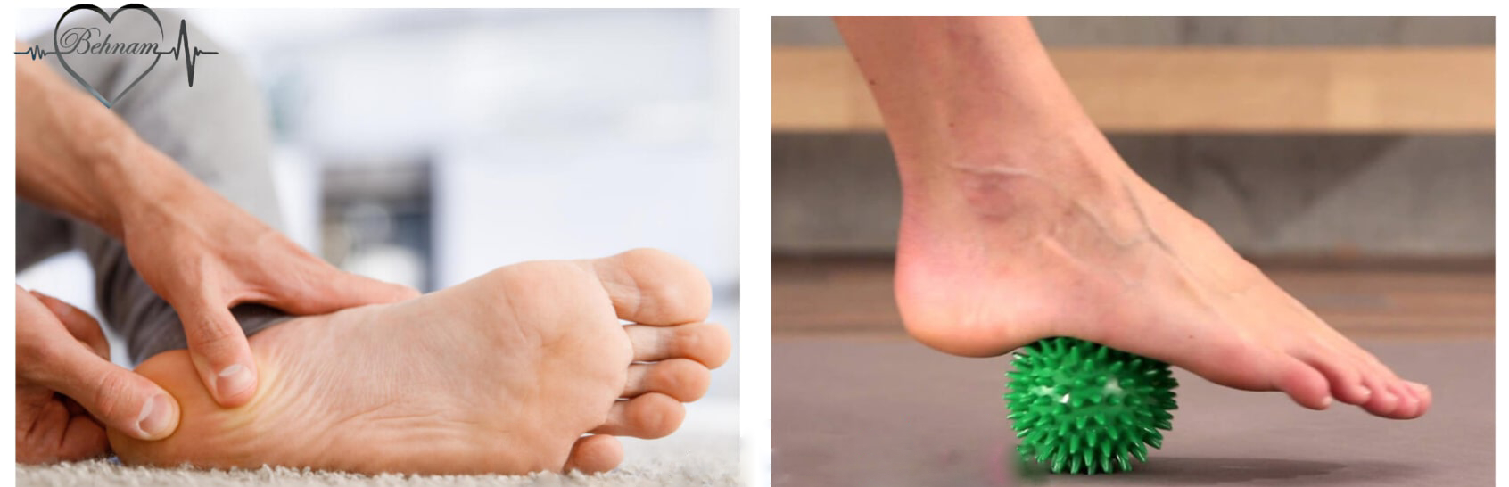 Varicose Veins Massage