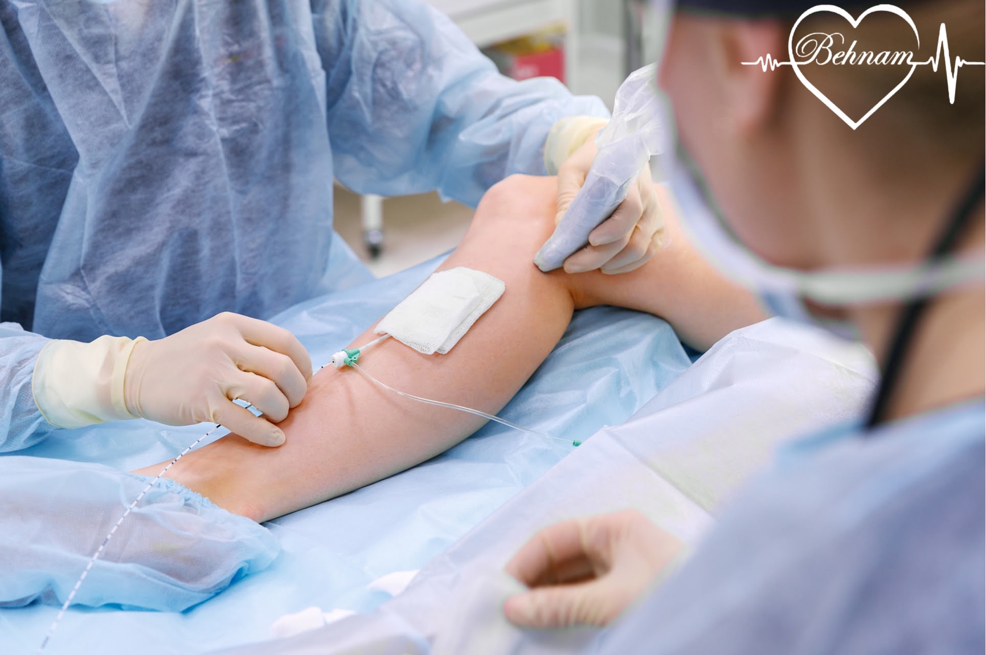 Is there a treatment for varicose veins?