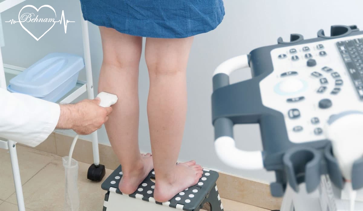 Varicose veins in children and adolescents