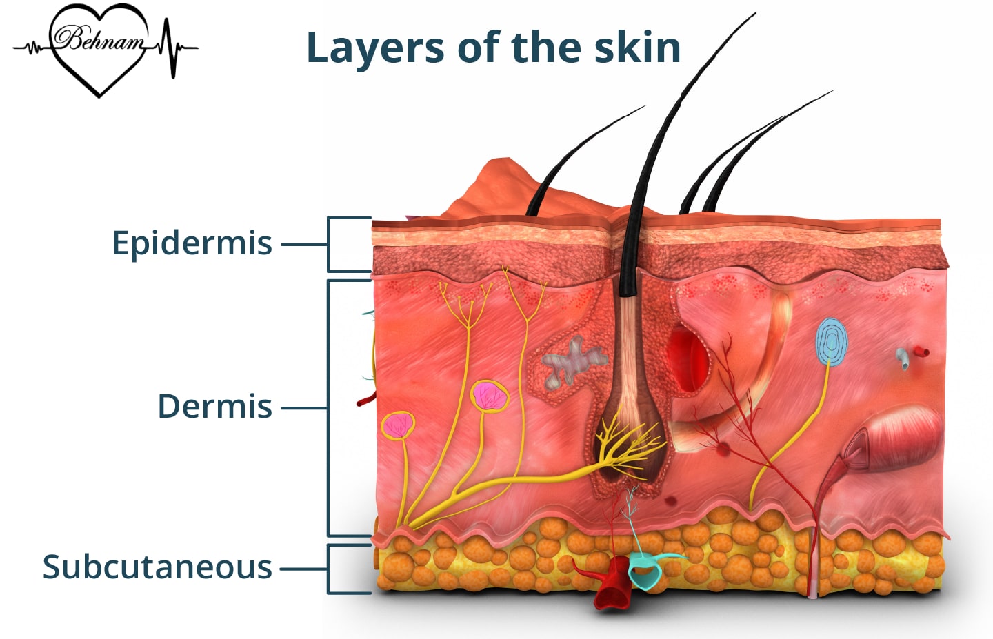 causes of Stretch marks