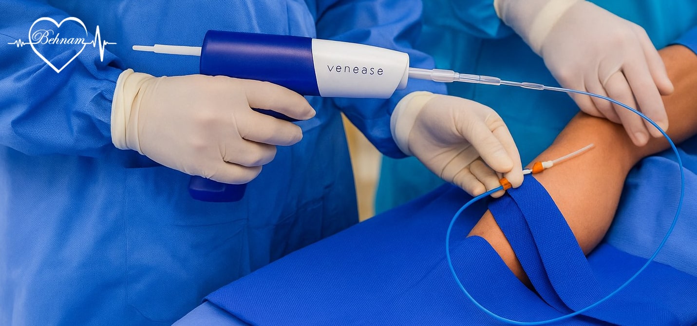glue for varicose veins