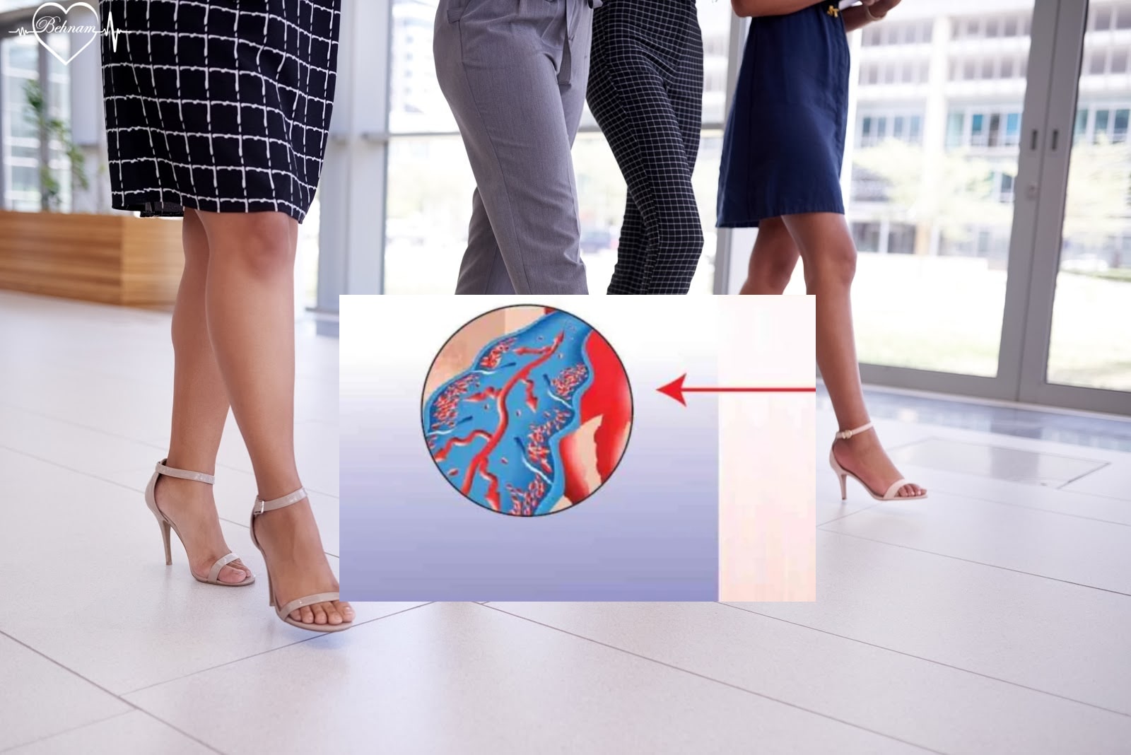 varicose veins and jobs